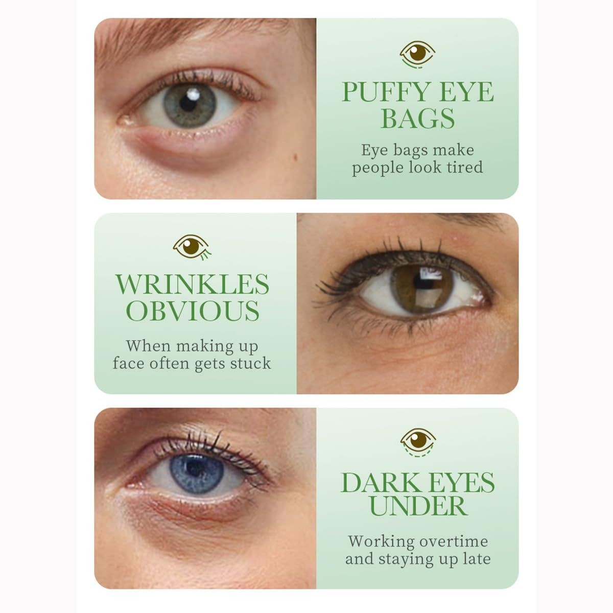 Three close-up photographs of under-eye concerns: puffiness, fine lines and dark shadowing.